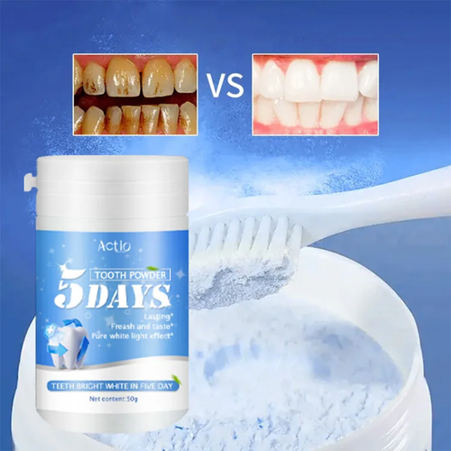 Blanchiment Dentaire